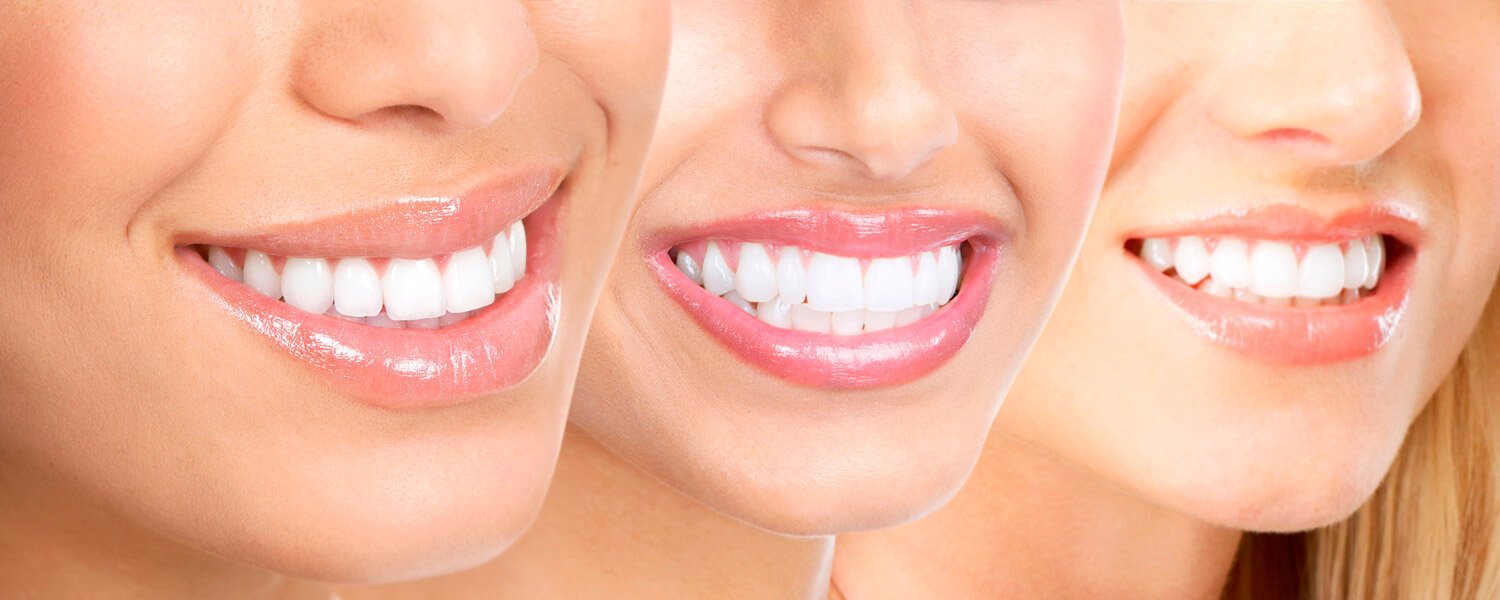 Estética Dental las Rozas Estética Dental las Rozas