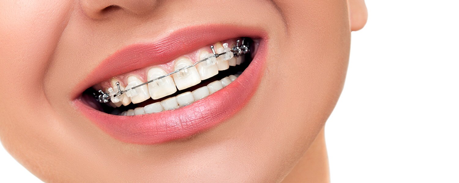 Ortodoncia las Rozas Ortodoncia las Rozas
