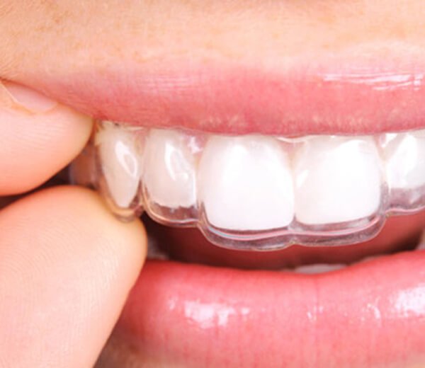 Ortodoncia las Rozas Ortodoncia las Rozas