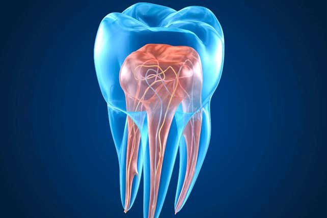 Situaciones para recurrir a una endodoncia